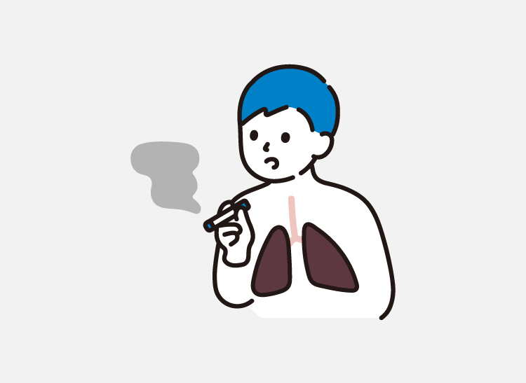 COPD/肺気腫